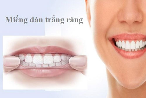 Lưu ý khi sử dụng miệng dán trắng răng