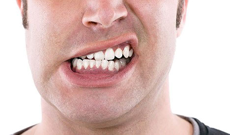 Nguyên nhân gây nứt răng gặp ở thói quen xấu