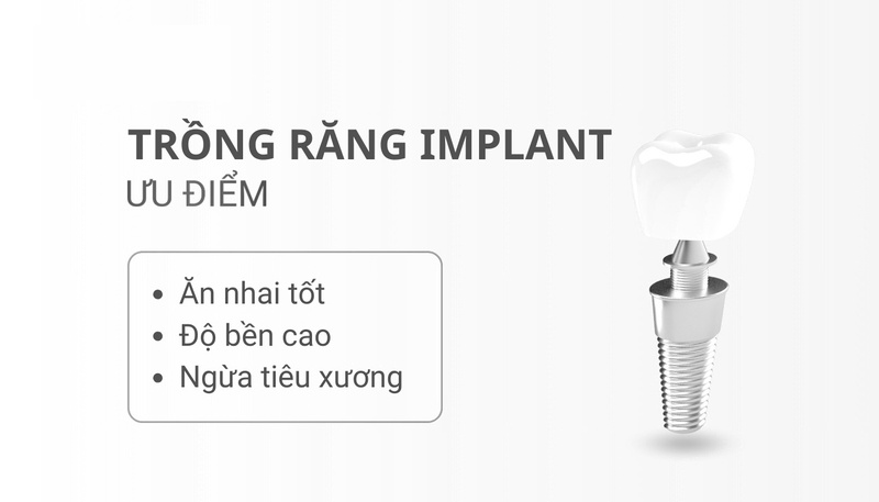 Trồng răng Implant mang phục hình răng mất toàn diện