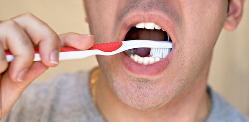Răng khôn mọc thẳng nên chú ý vệ sinh kỹ lưỡng để tránh mắc bệnh lý
