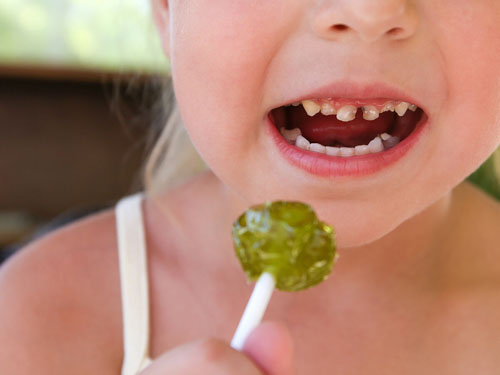 Ăn nhiều kẹo ngọt dễ khiến răng của trẻ bị sâu hỏng