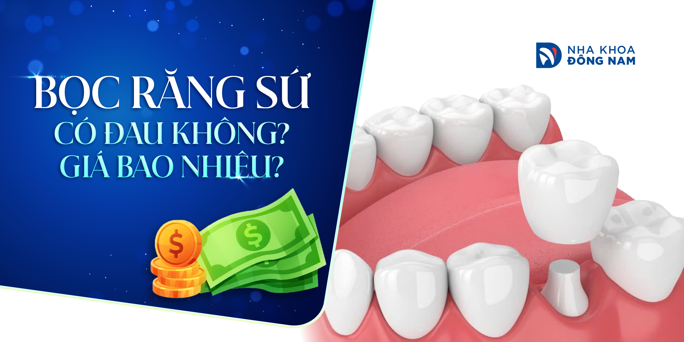 bọc răng sứ có đau không giá bao nhiêu