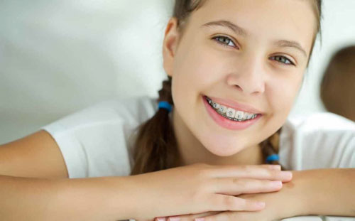 Giai đoạn 12 – 16 tuổi là thời điểm tốt nhất để niềng răng