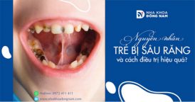 Nguyên nhân trẻ bị sâu răng và cách điều trị hiệu quả?