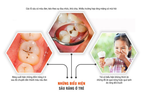 Nhận biết sâu răng sớm ở trẻ là rất cần thiết