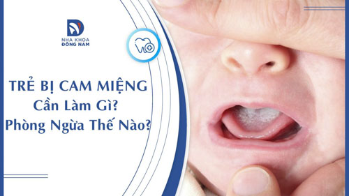 Trẻ bị cam miệng cần làm gì? Cách phòng ngừa như thế nào?