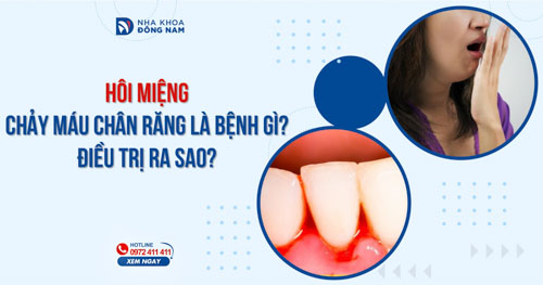 Hôi miệng chảy máu chân răng là bệnh gì? Điều trị ra sao?