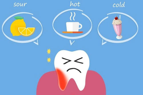 Triệu chứng ê buốt răng xuất hiện khi tiếp xúc với các kích thích bên ngoài