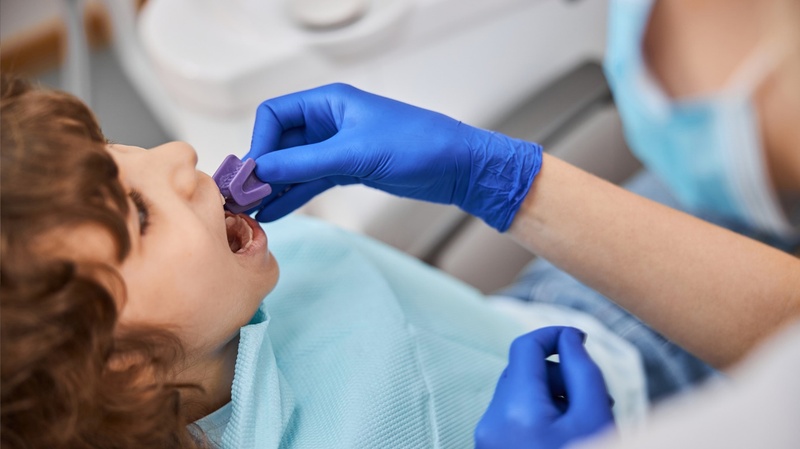 Nên đưa trẻ tới nha khoa nhổ răng để đảm bảo tính an toàn