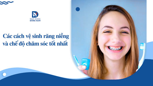 Cách vệ sinh răng niềng và chế độ chăm sóc tốt nhất