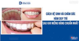 Cách vệ sinh và chăm sóc hàm duy trì sau khi niềng răng chuẩn nhất