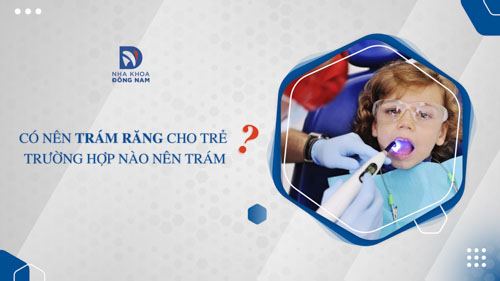 Có nên trám răng cho trẻ không? Trường hợp nào nên trám?
