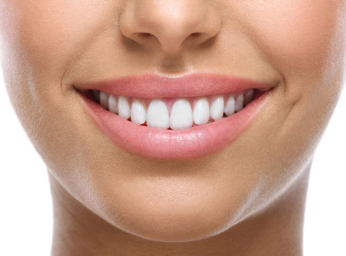 Dáng răng tròn giúp đường nét gương mặt trở nên mềm mại hơn