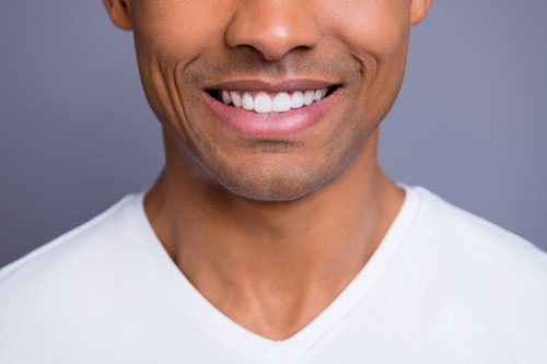 Dáng răng vuông góc cạnh thích hợp cho nam giới hoặc người cá tính mạnh