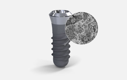 Điểm khác biệt giữa các trụ Implant nằm ở công nghệ xử lý bề mặt