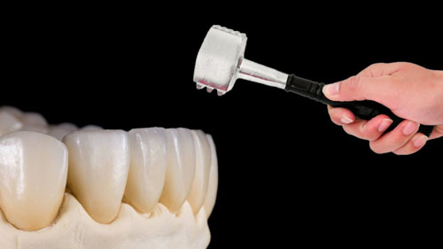 Độ bền và khả năng chịu lực của răng sứ Cercon tương đối tốt
