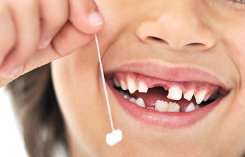 Dùng chỉ nha khoa là một trong những phương pháp nhổ răng tại nhà được nhiều cha mẹ sử dụng