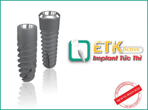 Implant ETK Active phù hợp cho hầu hết các tình trạng mất răng