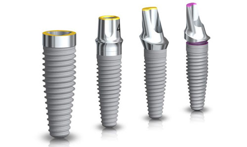 Implant Nobel Active là dòng trụ Implant lên răng tức thì cao cấp