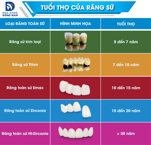 Mỗi loại răng sứ sẽ có tuổi thọ sử dụng khác nhau