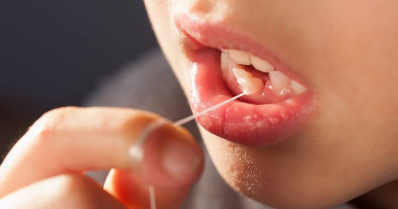 Nhổ răng bằng chỉ có nguy cơ tiềm ẩn nhiều rủi ro