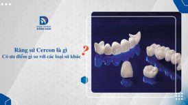 Răng sứ Cercon là gì ? Có ưu điểm gì so với các loại răng sứ khác ?