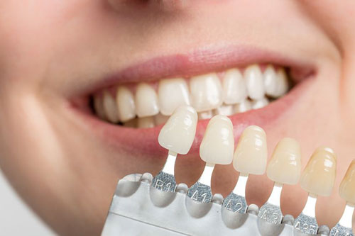 Răng sứ màu trắng đục mang lại tính chân thật cho nụ cười của bạn