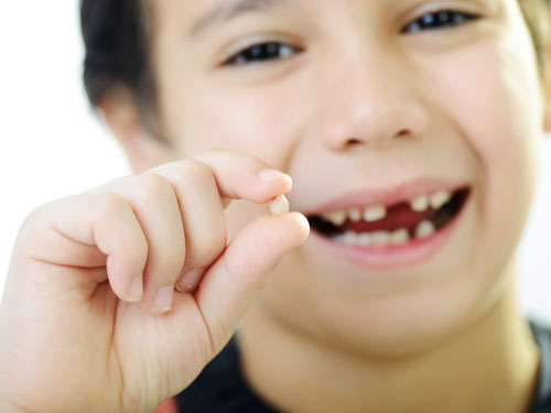 Răng sữa đến tuổi thay răng cần được nhổ bỏ để có chỗ cho răng vĩnh viễn mọc lên