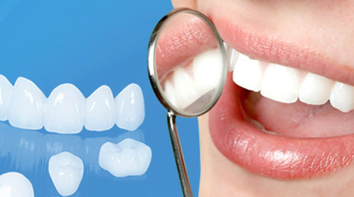 Số răng cần bọc sứ càng nhiều thì chi phí cũng tăng dần theo