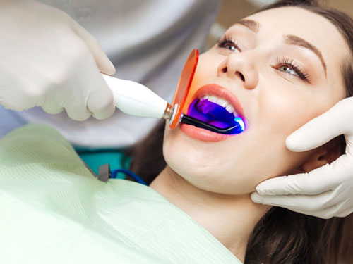 Trám răng với những trường hợp răng nhạy cảm do men răng bị tổn thương