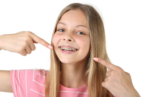 12 – 16 tuổi được xem là độ tuổi thích hợp để niềng răng cho con
