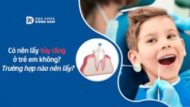 Có nên lấy tủy răng ở trẻ em không? Trường hợp nào nên lấy?