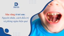 Nguyên nhân, cách điều trị và phòng ngừa sâu răng hiệu quả ở trẻ