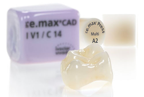 Răng sứ Emax có 2 công nghệ chế tác phổ biến