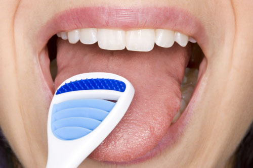 Sử dụng dụng cụ cạo lưỡi để làm sạch mảng bám trên bề mặt lưỡi