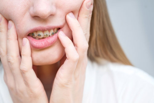 Tay nghề của bác sĩ không đảm bảo cũng là nguyên nhân gây hóp má khi niềng răng