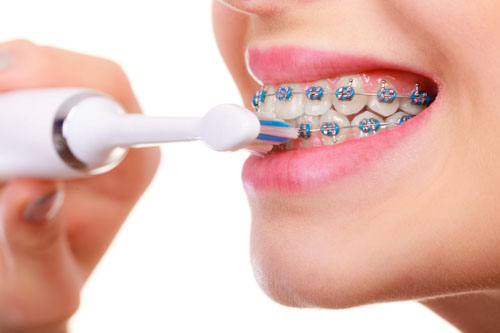 Vệ sinh răng sạch sẽ sau mỗi bữa ăn để ngăn ngừa sâu răng và hôi miệng