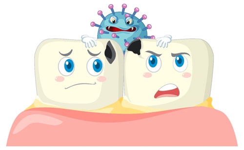 Vi khuẩn trong mảng bám là nguyên nhân gây sâu răng