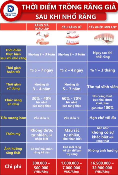 Bảng so sánh thời điểm trồng răng giả sau nhổ răng