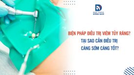 Biện pháp điều trị viêm tủy răng? Tại sao cần điều trị càng sớm càng tốt?