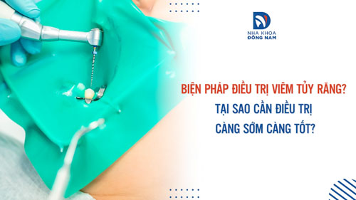 Biện pháp điều trị viêm tủy răng? Tại sao cần điều trị càng sớm càng tốt?