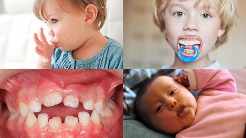 Các thói quen dễ gây hại cho hàm răng của trẻ cần sớm loại bỏ