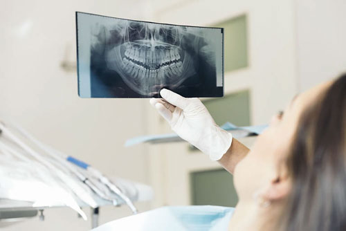 Chẩn đoán tình trạng răng miệng thông qua phim chụp X quang