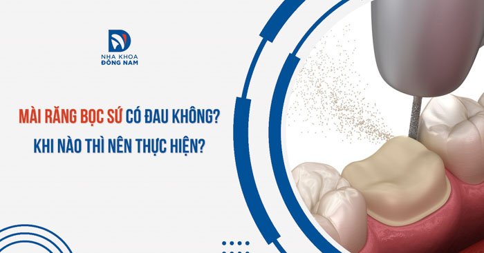 Mài răng bọc sứ có đau không? Khi nào thì nên thực hiện?