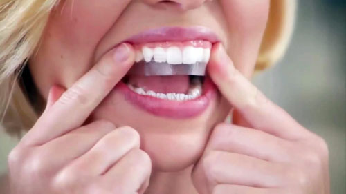 Miếng dán trắng răng cần dùng đúng cách để đạt hiệu quả cao