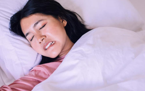 Nghiến răng khi ngủ là nguyên nhân gây trật khớp thái dương hàm