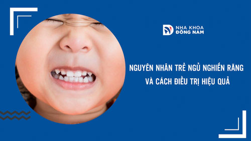 Nguyên nhân trẻ ngủ nghiến răng và cách điều trị hiệu quả