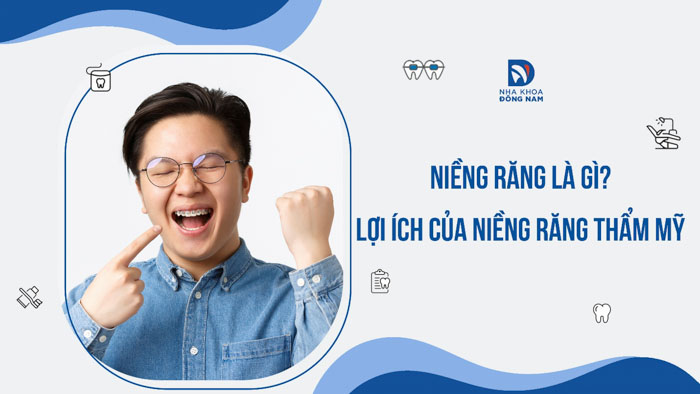 Niềng răng là gì? Lợi ích của niềng răng thẩm mỹ