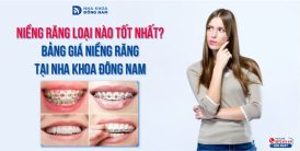 Niềng răng loại nào tốt nhất? Bảng giá niềng răng tại Nha khoa Đông Nam
