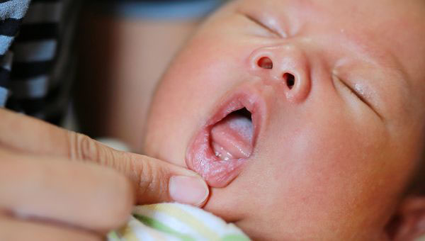 Theo dõi sát sao các dấu hiệu bất thường ở răng miệng của trẻ